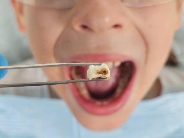 Best After-Hours Emergency Dentist in Crest, CA